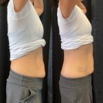 belly fats 8