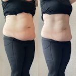 belly fats 6