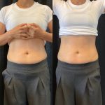 belly fats 3