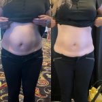 belly fats 7